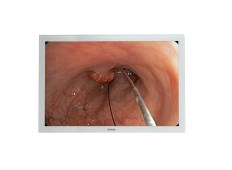 Surgical